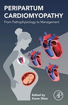 Peripartum Cardiomyopathy: From Pathophysiology to Management