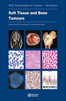 Soft Tissue and Bone Tumours: WHO Classification of Tumours (Medicine)