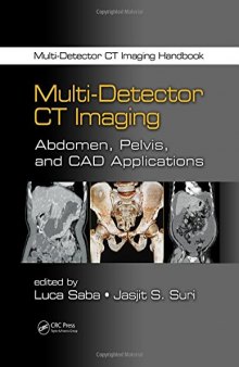 Multi-Detector CT Imaging Handbook, Two Volume Set: Multi-Detector CT Imaging: Abdomen, Pelvis, and CAD Applications