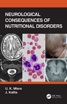 Neurological Consequences of Nutritional Disorders