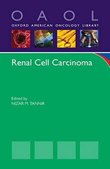 Renal Cell Carcinoma