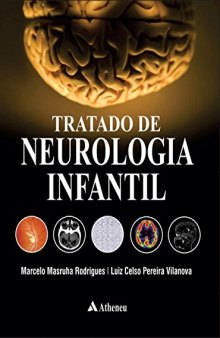 Tratado de Neurologia Infantil (Em Portuguese do Brasil)