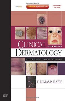 Clinical Dermatology. Expert Consult. Online And Print: A Color Guide to Diagnosis and Therapy