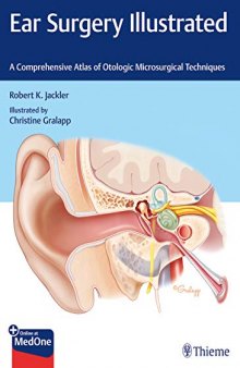 Ear Surgery Illustrated: A Comprehensive Atlas of Otologic Microsurgical Techniques