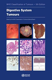 Digestive System Tumours: WHO Classification of Tumours