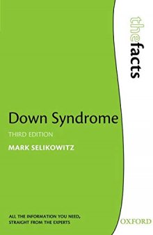 Down Syndrome