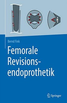 Femorale Revisionsendoprothetik (German Edition)
