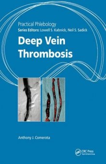 Practical Phlebology: Deep Vein Thrombosis