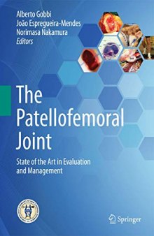 The Patellofemoral Joint: State of the Art in Evaluation and Management