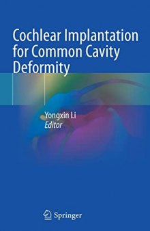 Cochlear Implantation for Common Cavity Deformity