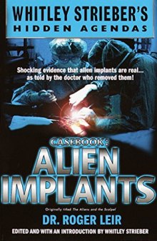 Casebook: Alien Implants (Whitley Streiber's Hidden Agendas)