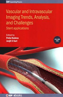 Vascular and Intravascular Imaging Trends, Analysis, and Challenges: Stent Applications