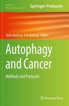 Autophagy and Cancer: Methods and Protocols
