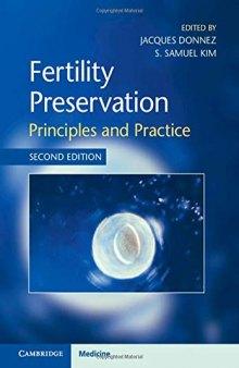 Fertility preservation principles and practice