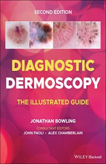 Diagnostic Dermoscopy - The Illustrated Guide
