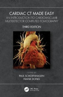 Cardiac Ct Made Easy: An Introduction to Cardiovascular Multidetector Computed Tomography