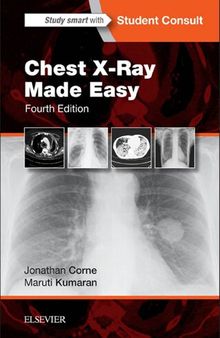 Chest X-Ray Made Easy, 4th Edition (TRUE PDF)