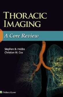 Thoracic Radiology: A Core Review