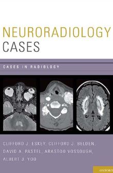Neuroradiology Cases (Cases in Radiology)