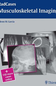 Radcases Musculoskeletal Radiology (Radcases Plus Q&A)