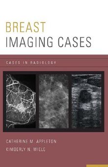 Breast Imaging Cases (Cases in Radiology)