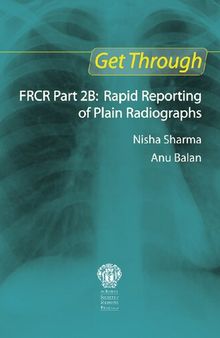 Get through FRCR part 2B : rapid reporting of plain radiographs