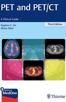 Pet and Pet/CT: A Clinical Guide
