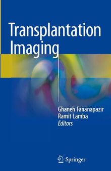 Transplantation Imaging