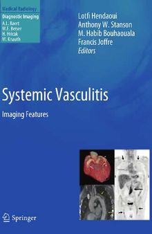 Systemic Vasculitis: Imaging Features (Medical Radiology)