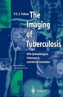 The Imaging of Tuberculosis: With Epidemiological, Pathological, and Clinical Correlation