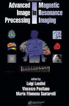 Advanced Image Processing in Magnetic Resonance Imaging (Signal Processing and Communications)