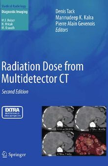 Radiation Dose from Multidetector CT (Medical Radiology)