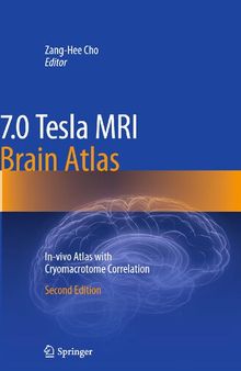 7.0 Tesla MRI Brain Atlas: In-vivo Atlas with Cryomacrotome Correlation