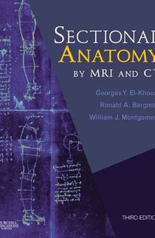 Sectional Anatomy by MRI and CT With Website,