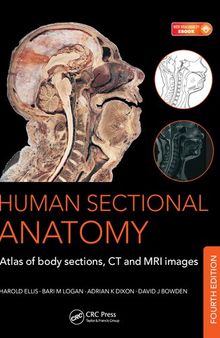 Human sectional anatomy : atlas of body sections, CT and MRI images