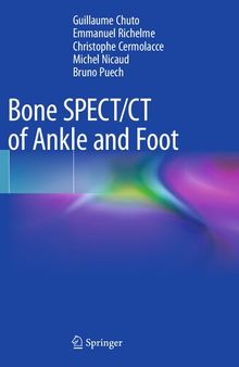 Bone SPECT/CT of Ankle and Foot