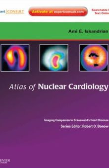 Atlas of Nuclear Cardiology: Imaging Companion to Braunwald's Heart Disease: Expert Consult - Online and Print (Imaging Techniques to Braunwald's Heart Disease)