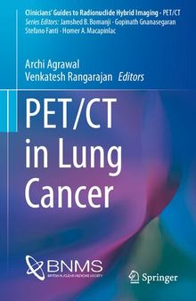 PET/CT in Lung Cancer (Clinicians’ Guides to Radionuclide Hybrid Imaging)