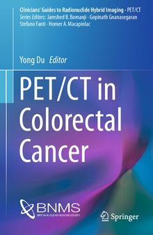 PET/CT in Colorectal Cancer (Clinicians’ Guides to Radionuclide Hybrid Imaging)