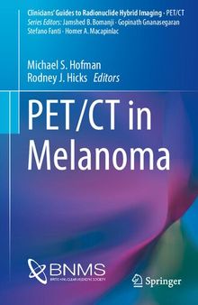PET/CT in Melanoma (Clinicians’ Guides to Radionuclide Hybrid Imaging)