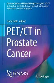 PET/CT in Prostate Cancer (Clinicians’ Guides to Radionuclide Hybrid Imaging)