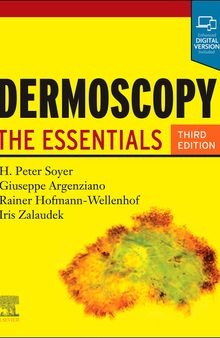 Dermoscopy: The Essentials
