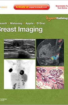 Breast Imaging: Expert Radiology Series