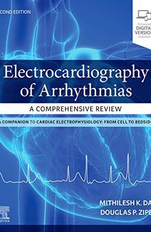 Electrocardiography of Arrhythmias: A Comprehensive Review: A Companion to Cardiac Electrophysiology