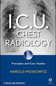 I.C.U. Chest Radiology: Principles and Case Studies