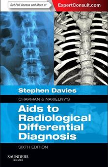 Chapman & Nakielny's Aids to Radiological Differential Diagnosis: Expert Consult - Online and Print