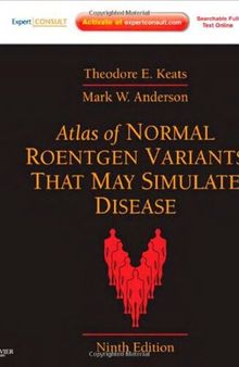 Atlas of Normal Roentgen Variants That May Simulate Disease