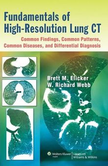Fundamentals of High-Resolution Lung CT: Common Findings, Common Patters, Common Diseases and Differential Diagnosis: Common Findings, Common Patterns, Common Diseases, and Differential Diagnosis