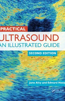 Practical ultrasound : an illustrated guide