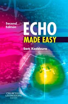 Echo Made Easy